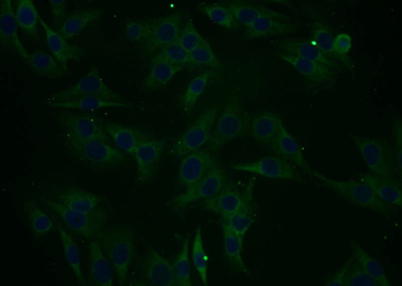 Immunofluorescent analysis of A375 cells using Catalog No:114578(RCL1 Antibody) at dilution of 1:25 and Alexa Fluor 488-congugated AffiniPure Goat Anti-Rabbit IgG(H+L)