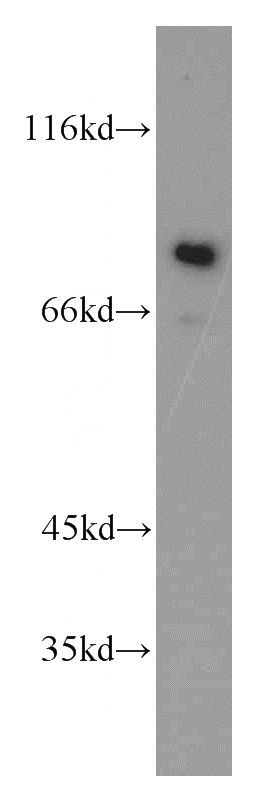 mouse kidney tissue were subjected to SDS PAGE followed by western blot with Catalog No:108184(ARHGEF16 antibody) at dilution of 1:100