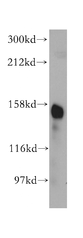 human kidney tissue were subjected to SDS PAGE followed by western blot with Catalog No:109046(ANPEP antibody) at dilution of 1:500