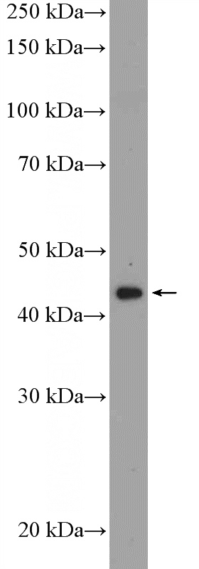 SH-SY5Y cells were subjected to SDS PAGE followed by western blot with Catalog No:112429(MAP9 Antibody) at dilution of 1:600