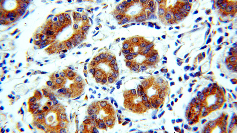 Immunohistochemical of paraffin-embedded human stomach using Catalog No:109215(CHCHD6 antibody) at dilution of 1:100 (under 40x lens)
