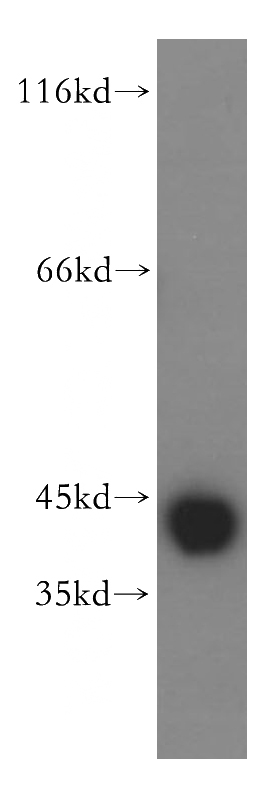 mouse brain tissue were subjected to SDS PAGE followed by western blot with Catalog No:113678(PDHA1 antibody) at dilution of 1:500