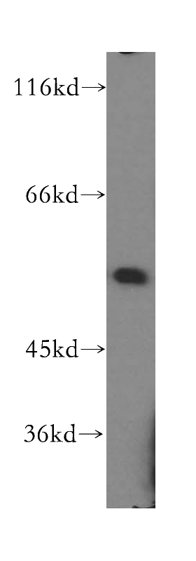 Jurkat cells were subjected to SDS PAGE followed by western blot with Catalog No:111832(IRF2 antibody) at dilution of 1:500