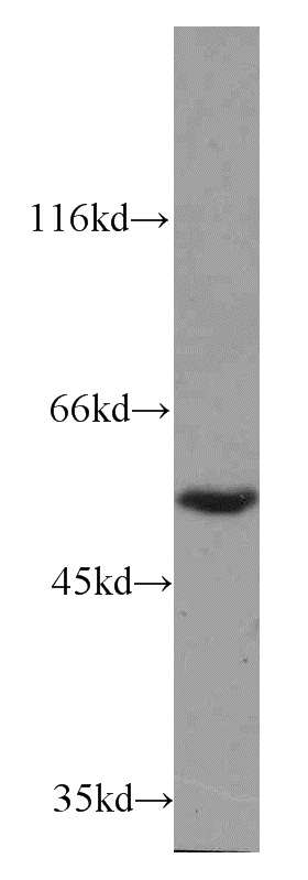 K-562 cells were subjected to SDS PAGE followed by western blot with Catalog No:110467(FAM124B antibody) at dilution of 1:600