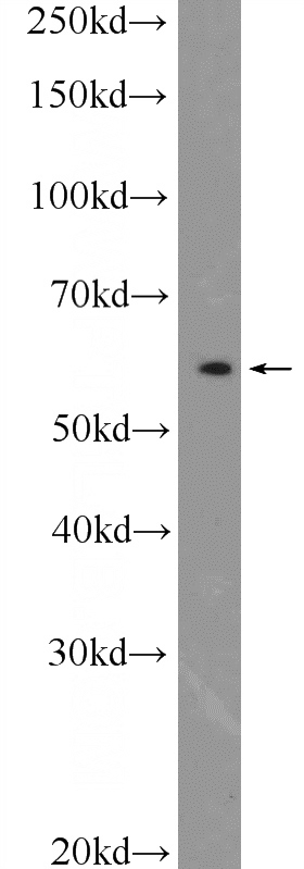 mouse brain tissue were subjected to SDS PAGE followed by western blot with Catalog No:114388(PSMC1 Antibody) at dilution of 1:1000