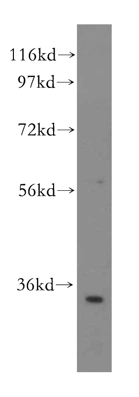 HepG2 cells were subjected to SDS PAGE followed by western blot with Catalog No:114898(RPL6 antibody) at dilution of 1:500