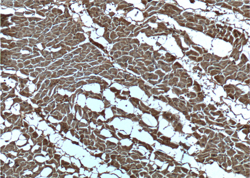Immunohistochemistry of paraffin-embedded human heart tissue slide using Catalog No:107182(CUL4A Antibody) at dilution of 1:200 (under 10x lens).