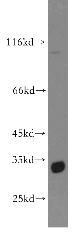 PC-3 cells were subjected to SDS PAGE followed by western blot with Catalog No:115562(SRM antibody) at dilution of 1:500
