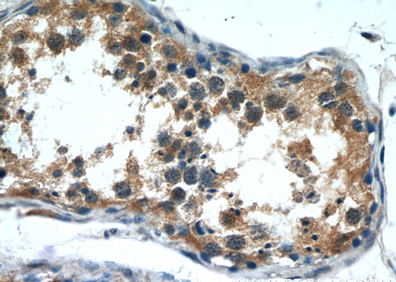 Immunohistochemistry of paraffin-embedded human testis tissue slide using Catalog No:110654(FIBP Antibody) at dilution of 1:50 (under 40x lens)