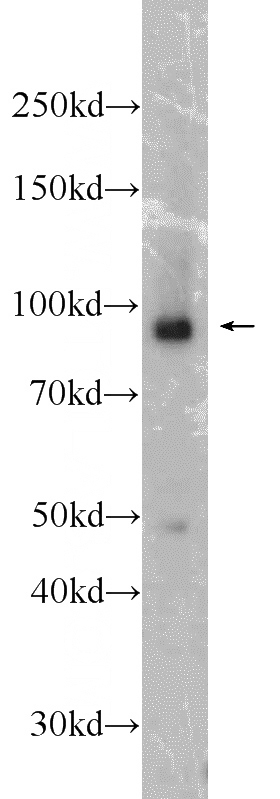 Raji cells were subjected to SDS PAGE followed by western blot with Catalog No:112423(MAP4K1 antibody) at dilution of 1:1000