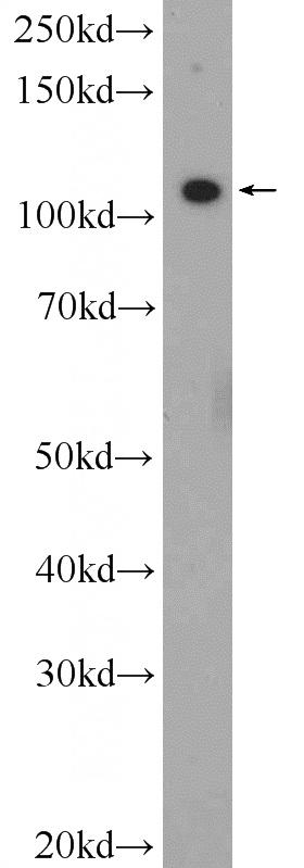 PC-3 cells were subjected to SDS PAGE followed by western blot with Catalog No:110932(GEF-H1 Antibody) at dilution of 1:1000