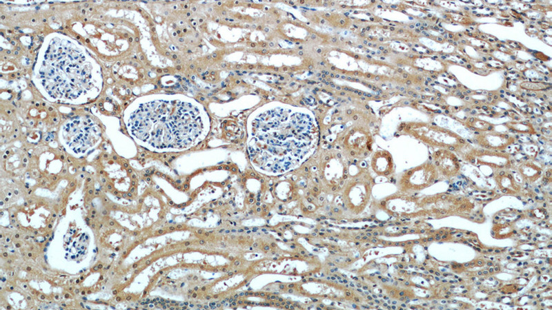Immunohistochemical of paraffin-embedded human kidney using Catalog No:110906(GCLC antibody) at dilution of 1:50 (under 10x lens)