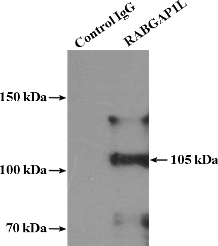 IP Result of anti-RABGAP1L (IP:Catalog No:114497, 4ug; Detection:Catalog No:114497 1:1000) with HeLa cells lysate 3200ug.