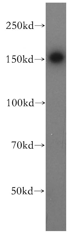 K-562 cells were subjected to SDS PAGE followed by western blot with Catalog No:114316(PTPN14 antibody) at dilution of 1:400