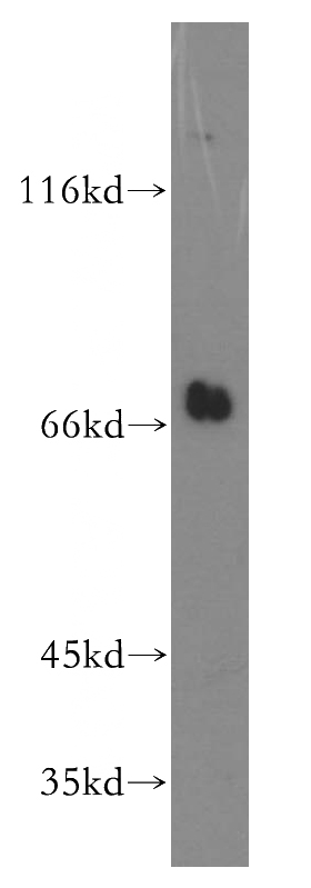 mouse kidney tissue were subjected to SDS PAGE followed by western blot with Catalog No:113218(NPLoc4 antibody) at dilution of 1:200