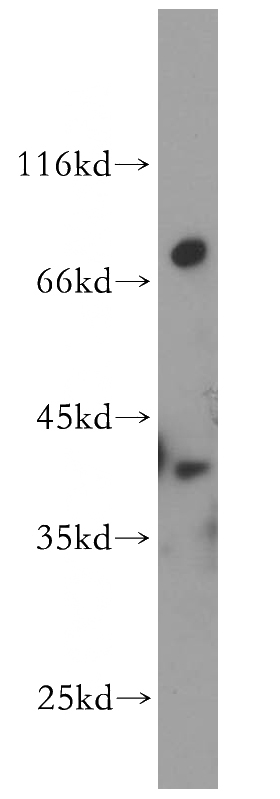mouse brain tissue were subjected to SDS PAGE followed by western blot with Catalog No:110054(DOK6 antibody) at dilution of 1:600