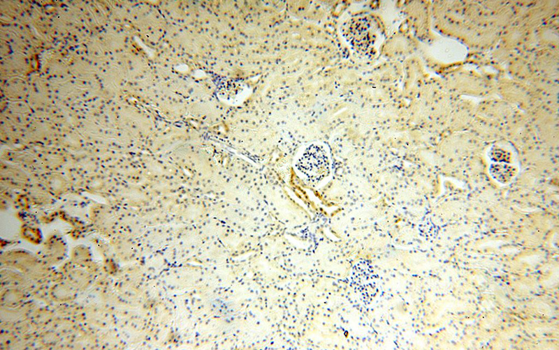 Immunohistochemical of paraffin-embedded human kidney using Catalog No:113521(OVCA2 antibody) at dilution of 1:50 (under 10x lens)