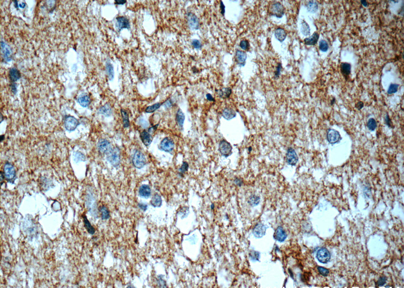 Immunohistochemistry of paraffin-embedded human brain slide using Catalog No:108345(ATP1B2 Antibody) at dilution of 1:50