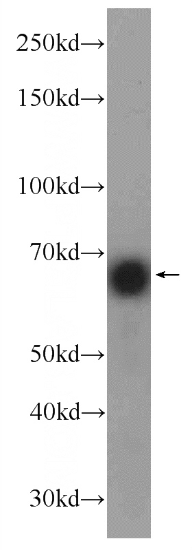 HEK-293 cells were subjected to SDS PAGE followed by western blot with Catalog No:111520(HOMEZ Antibody) at dilution of 1:1000