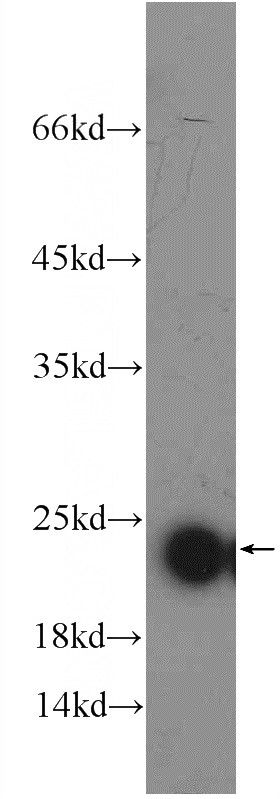 rat liver tissue were subjected to SDS PAGE followed by western blot with Catalog No:114349(PXMP2 Antibody) at dilution of 1:600