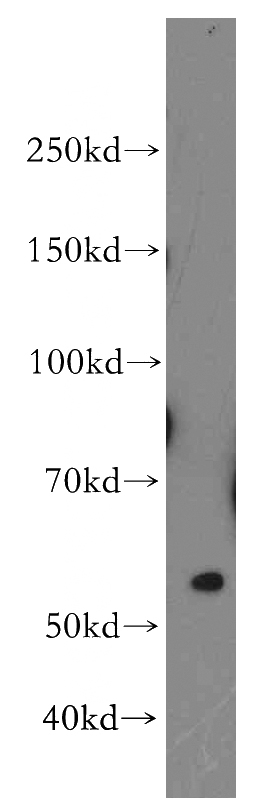 HepG2 cells were subjected to SDS PAGE followed by western blot with Catalog No:109195(CES7-Specific antibody) at dilution of 1:300