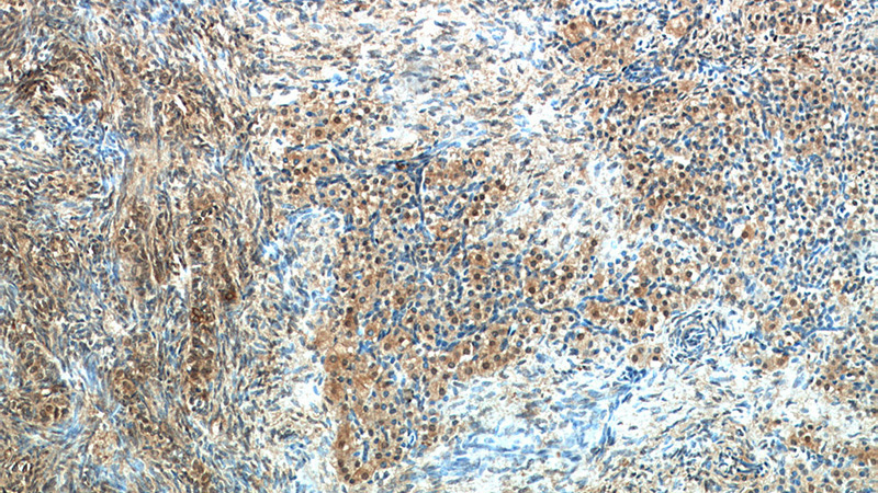 Immunohistochemical of paraffin-embedded human ovary using Catalog No:116861(WDR24 antibody) at dilution of 1:50 (under 10x lens)