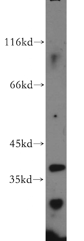 human testis tissue were subjected to SDS PAGE followed by western blot with Catalog No:108975(CCDC42 antibody) at dilution of 1:500