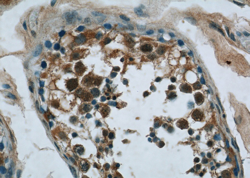 Immunohistochemistry of paraffin-embedded human testis tissue slide using Catalog No:113031(NCAPG Antibody) at dilution of 1:50 (under 40x lens)
