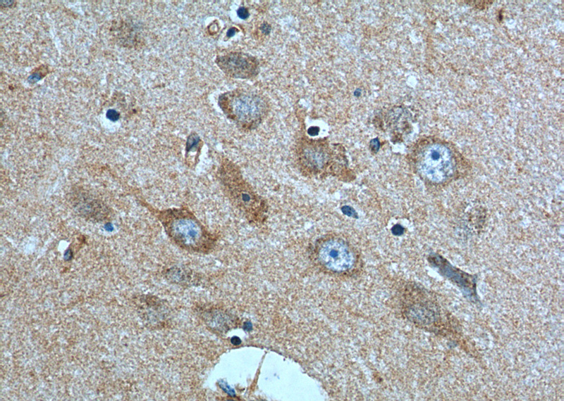 Immunohistochemistry of paraffin-embedded human brain tissue slide using Catalog No:111709(HTR1B Antibody) at dilution of 1:100 (under 40x lens).