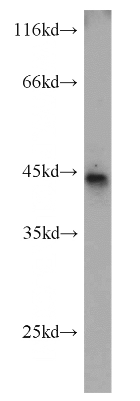mouse placenta tissue were subjected to SDS PAGE followed by western blot with Catalog No:117085(B3GALNT1 antibody) at dilution of 1:1000