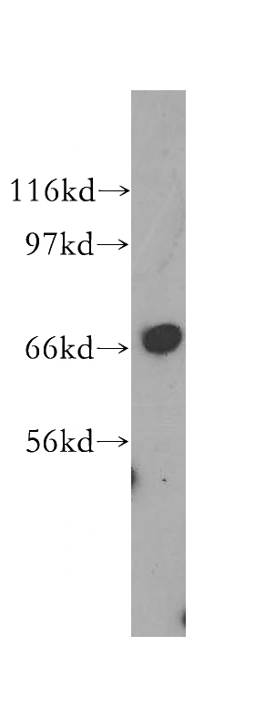 A549 cells were subjected to SDS PAGE followed by western blot with Catalog No:114991(SCFD1 antibody) at dilution of 1:500