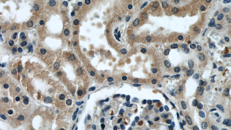 Immunohistochemical of paraffin-embedded human kidney using Catalog No:112048(KIF5B antibody) at dilution of 1:100 (under 40x lens)