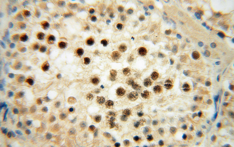Immunohistochemical of paraffin-embedded human testis using Catalog No:114729(RNASEH2A antibody) at dilution of 1:50 (under 40x lens)