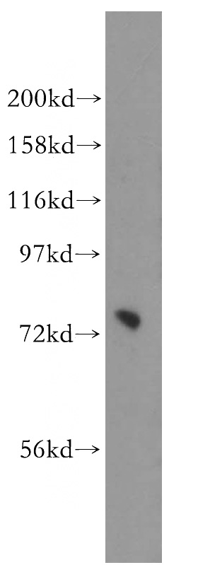 HeLa cells were subjected to SDS PAGE followed by western blot with Catalog No:113895(PIGO antibody) at dilution of 1:300