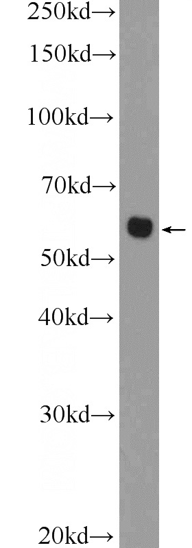 Jurkat cells were subjected to SDS PAGE followed by western blot with Catalog No:109290(CHST1 Antibody) at dilution of 1:600