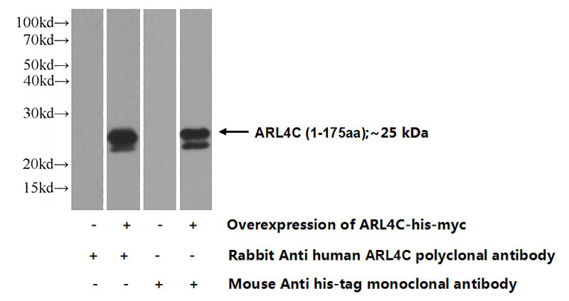 Transfected HEK-293 cells were subjected to SDS PAGE followed by western blot with Catalog No:108202(ARL4C Antibody) at dilution of 1:1000