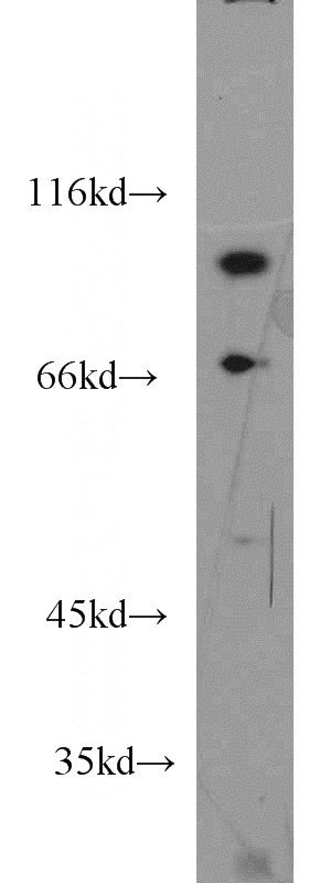 HepG2 cells were subjected to SDS PAGE followed by western blot with Catalog No:116788(VPS41 antibody) at dilution of 1:400