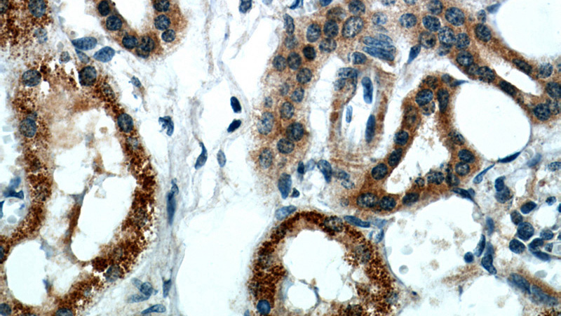 Immunohistochemical of paraffin-embedded human kidney using Catalog No:108371(BBS4 antibody) at dilution of 1:50 (under 40x lens)