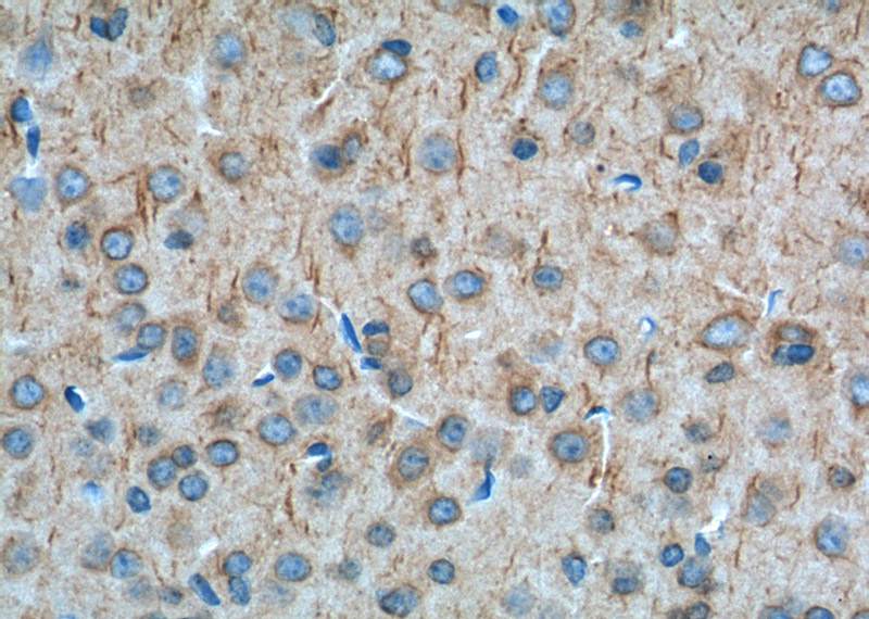 Immunohistochemistry of paraffin-embedded mouse brain tissue slide using Catalog No:108930(CNR1 Antibody) at dilution of 1:100 (under 40x lens). heat mediated antigen retrieved with Tris-EDTA buffer(pH9).