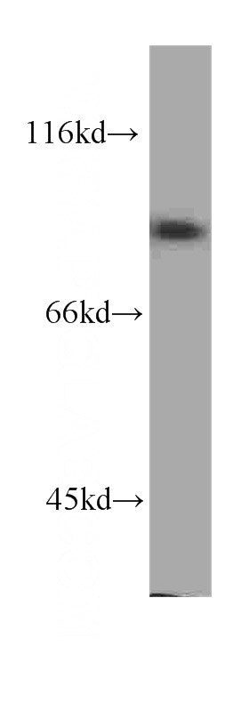 K-562 cells were subjected to SDS PAGE followed by western blot with Catalog No:107512(RRM1 antibody) at dilution of 1:1000