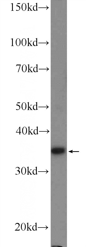 HEK-293 cells were subjected to SDS PAGE followed by western blot with Catalog No:114596(RBM11 Antibody) at dilution of 1:300