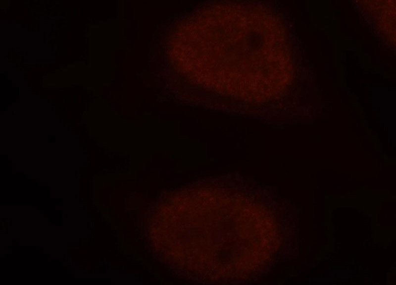 Immunofluorescent analysis of MCF-7 cells, using NUDT21 antibody Catalog No:113360 at 1:50 dilution and Rhodamine-labeled goat anti-rabbit IgG (red).