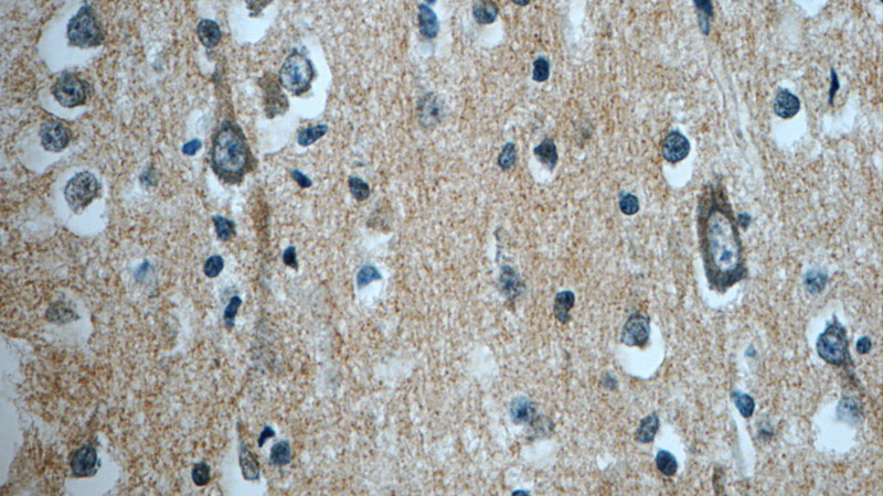 Immunohistochemistry of paraffin-embedded human brain tissue slide using Catalog No:109951(DNAJC6 Antibody) at dilution of 1:50 (under 40x lens)