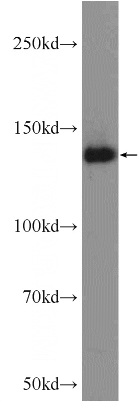HeLa cells were subjected to SDS PAGE followed by western blot with Catalog No:116544(UBE4B Antibody) at dilution of 1:3000