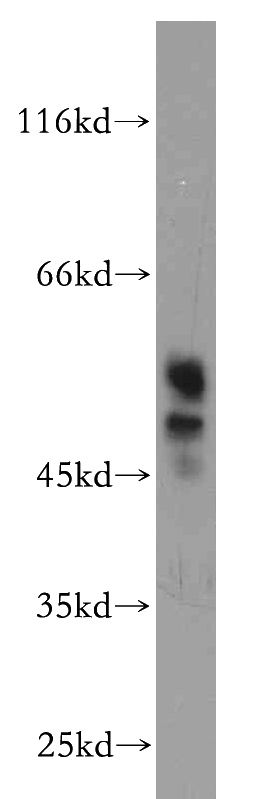 SH-SY5Y cells were subjected to SDS PAGE followed by western blot with Catalog No:115777(SYT4 antibody) at dilution of 1:500
