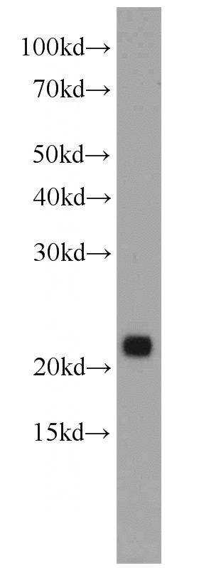 mouse pancreas tissue were subjected to SDS PAGE followed by western blot with Catalog No:114314(PTPMT1 antibody) at dilution of 1:300