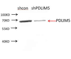 NIH3T3 cells were subjected to SDS PAGE followed by western blot with Catalog No:113631(PDLIM5 antibody) at dilution of 1:250. (Data provided by Angran Biotech (www.miRNAlab.com)).