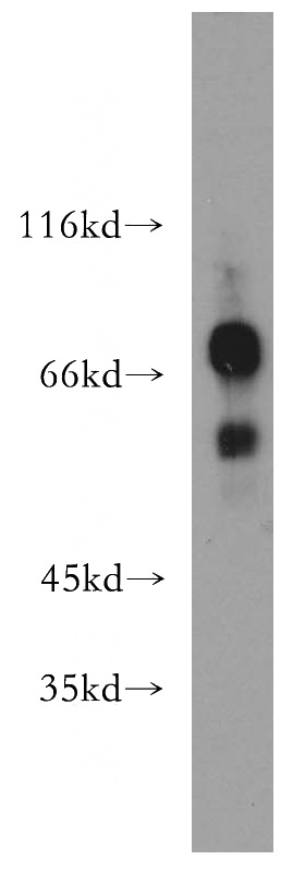 Jurkat cells were subjected to SDS PAGE followed by western blot with Catalog No:111649(IKZF3 antibody) at dilution of 1:300