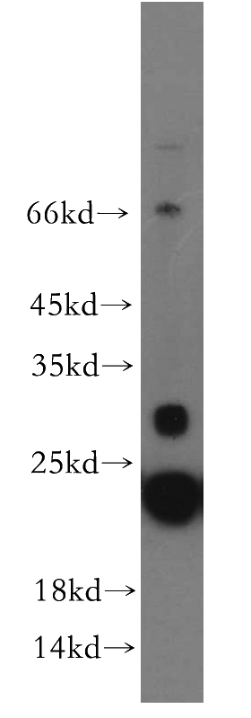 human brain tissue were subjected to SDS PAGE followed by western blot with Catalog No:114411(RAB11A-Specific antibody) at dilution of 1:500