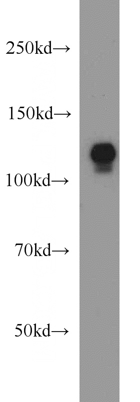 HeLa cells were subjected to SDS PAGE followed by western blot with Catalog No:109938(DIAPH3 antibody) at dilution of 1:1000